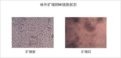 体外扩增的NK细胞状态